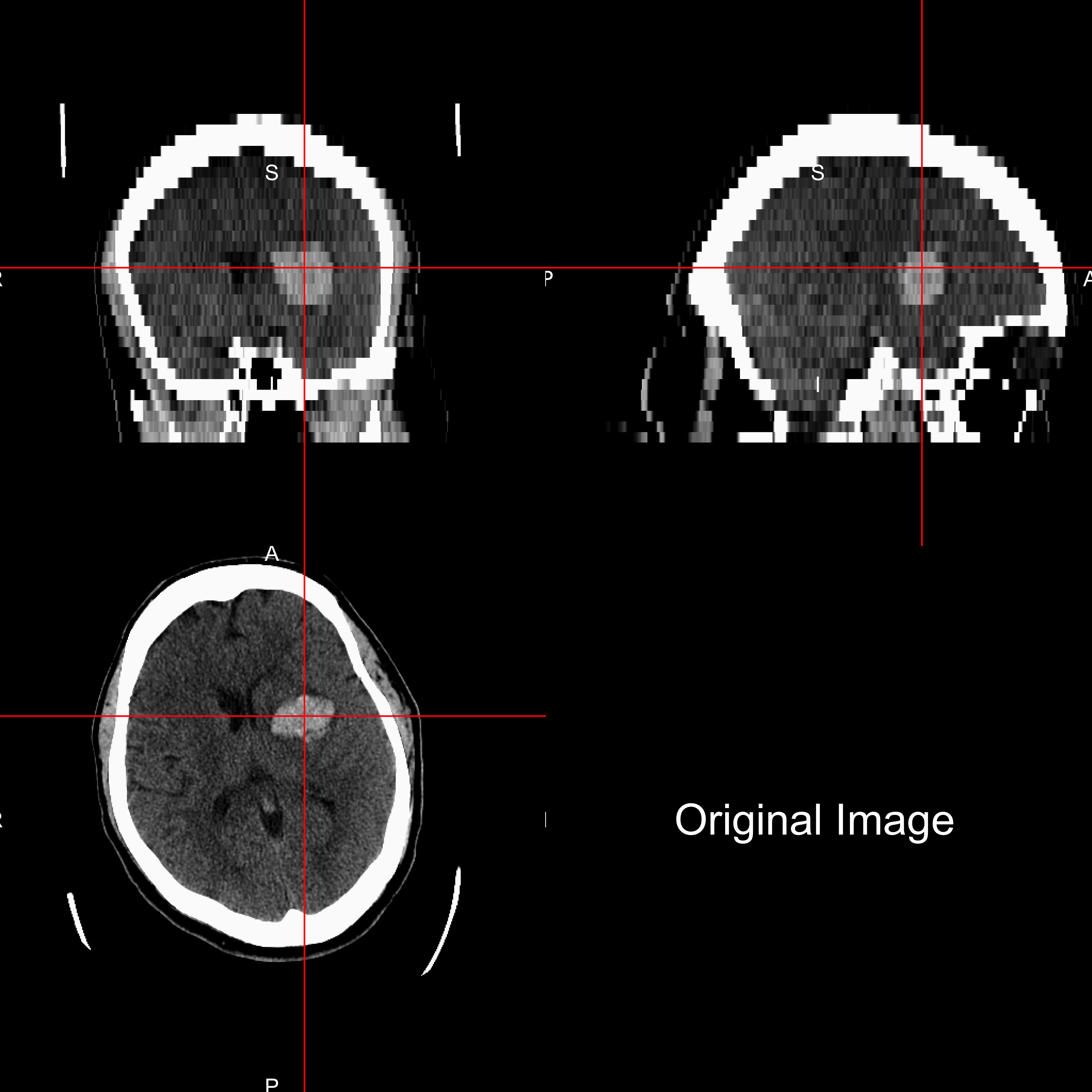 Brain Image